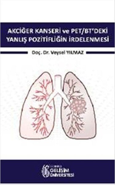 Akciğer Kanseri ve PET-BT'deki Yanlış Pozitifliğin İrdelenmesi