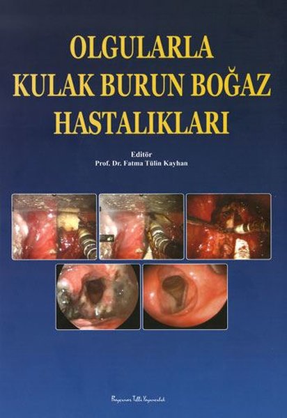 Olgularla Kulak Burun Boğaz Hastalıkları